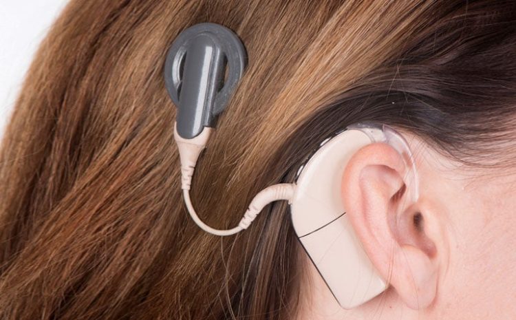 Best Cochlear Implants Surgery At Lowest Cost in Delhi