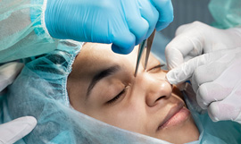 septoplasty surgery in delhi